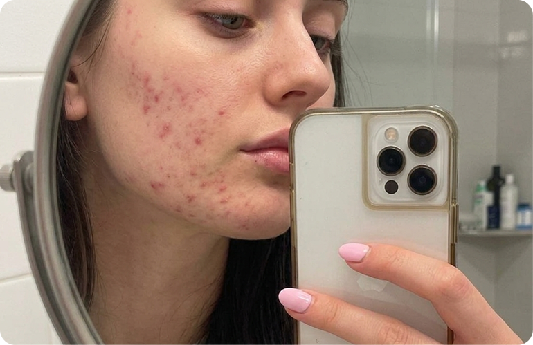 Woman applying skincare